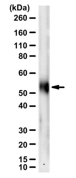 Parkin Mouse anti-Human, Rat, Mouse, Clone: PRK8, MilliporeSigma 100 &mu;L;